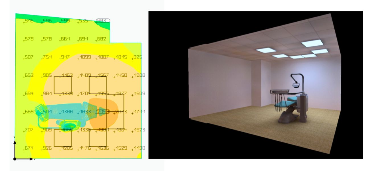 treatmentroom Light calculation with Dented lighiting