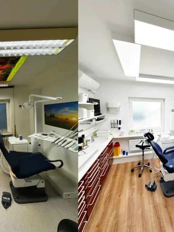 Before and after comparison of dental treatment room lighting upgraded to LED